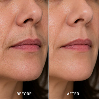 Sizura™ Hormonal Hair Remover