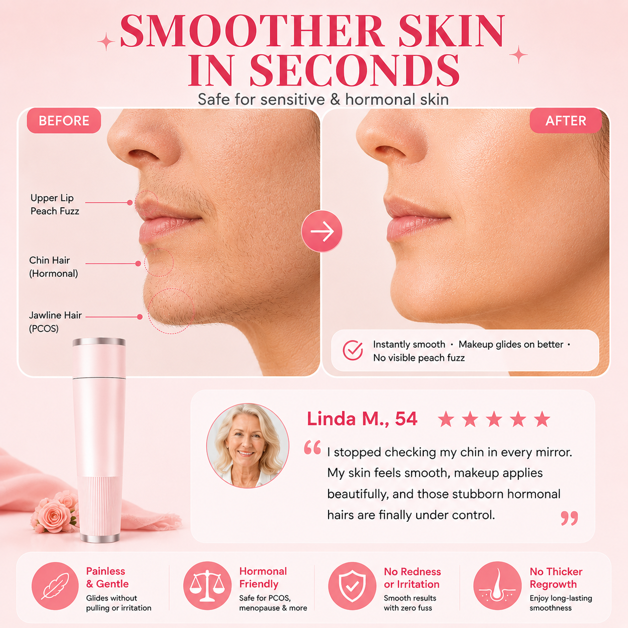 Sizura™ Hormonal Hair Remover