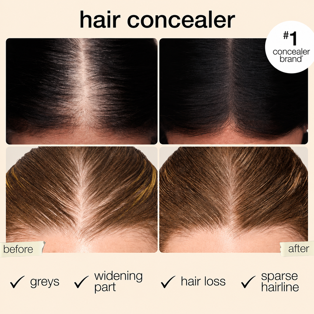 Sizura™ Hair Concealer